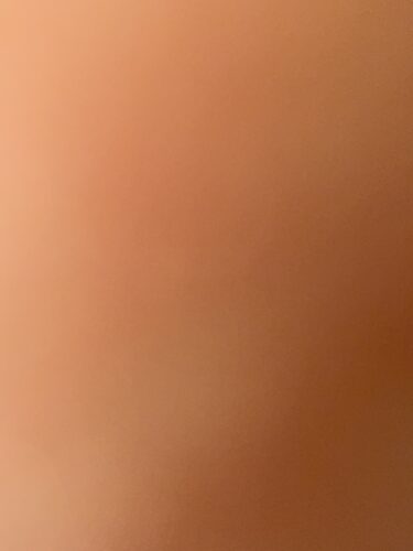 Generic HGH 100IU photo review